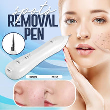 Load image into Gallery viewer, Facial Spots Removal Pen
