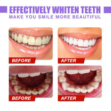 Load image into Gallery viewer, Teeth Colour Corrector Serum
