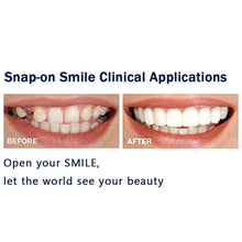 Load image into Gallery viewer, Magic Smile Teeth Brace

