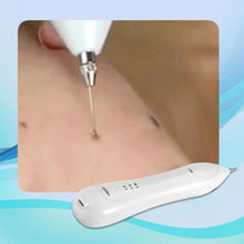Load image into Gallery viewer, Facial Spots Removal Pen
