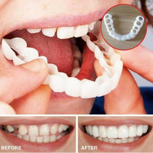 Load image into Gallery viewer, Magic Smile Teeth Brace
